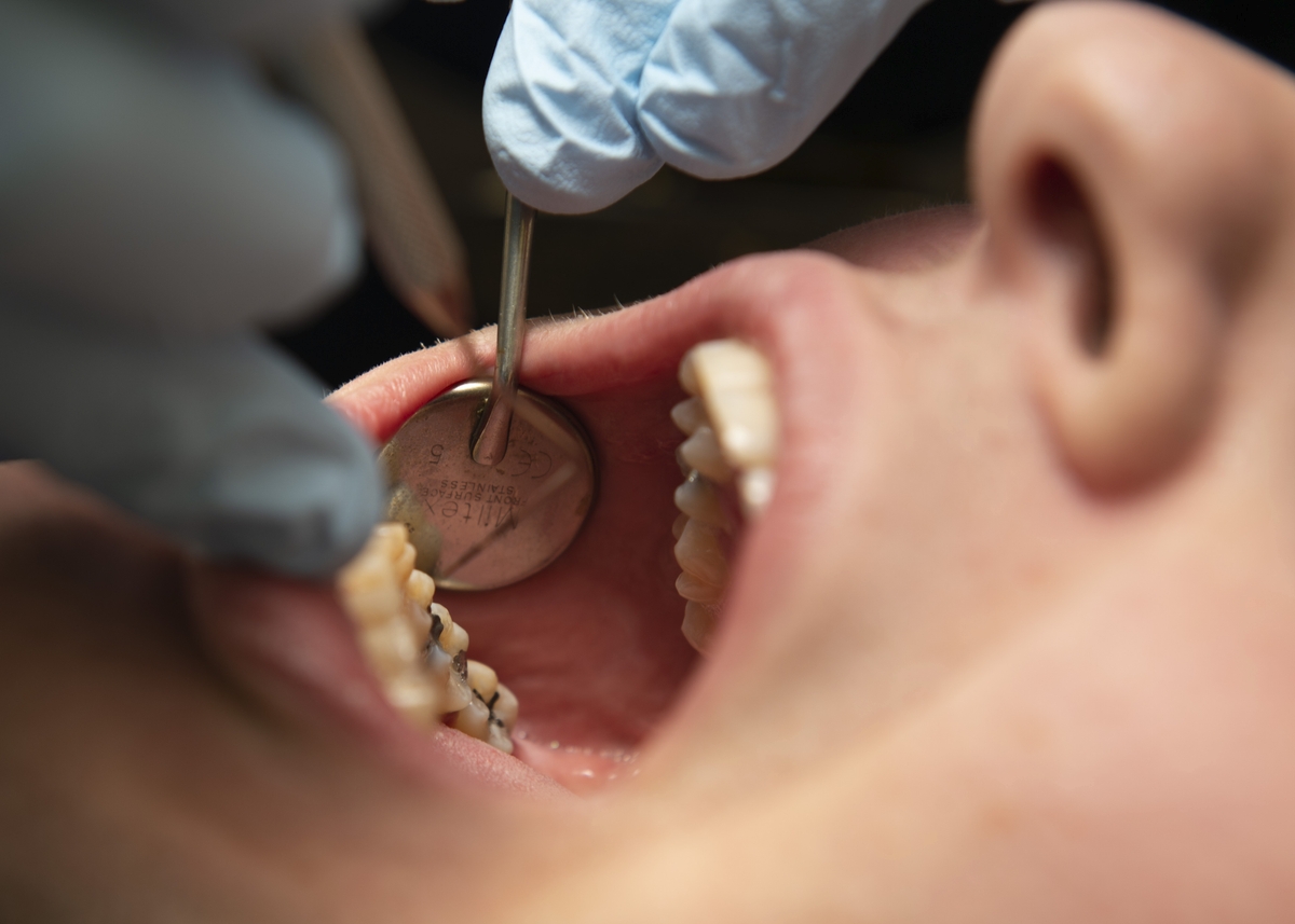 Immagine del dettaglio di un paziente in odontoiatria